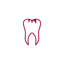 Fissurenversiegelung